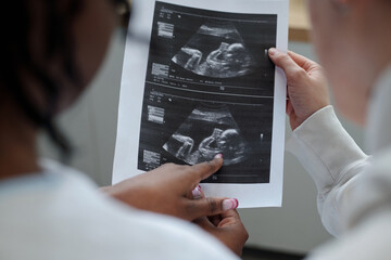 Healthcare professional holding and showing ultrasound images during prenatal checkup illustrating baby development and monitoring health progress without any medical apparatus in view