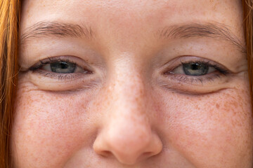 Close-up of woman's eyes and nose, showing natural freckles and skin texture