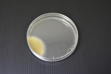 Colonies of bacteria growth on agar plate medium in laboratory.	