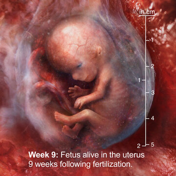 Fetus alive in the uterus 9 weeks following fertilization