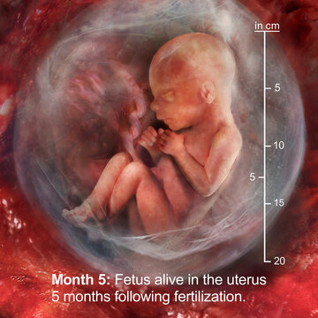 Fetus alive in the uterus 5 months following fertilization
