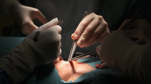 Surgeons performing thyroid gland removal surgery on patient