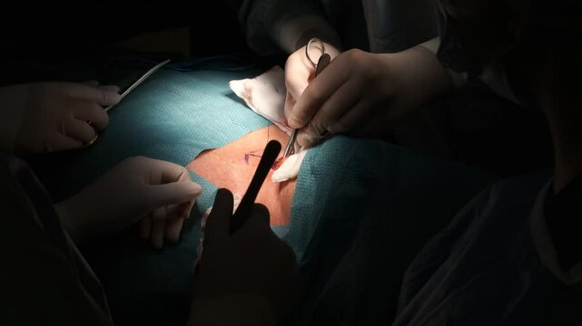 Surgeons stitching after thyroid gland removal in dark room