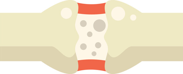 Illustration of a human joint showing osteoporosis affecting bones with porous texture