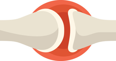 This illustration shows two bones connected by a joint, with a red area indicating inflammation and pain
