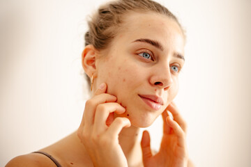 A young woman inspects her skin in natural light, focusing on blemishes while considering her...