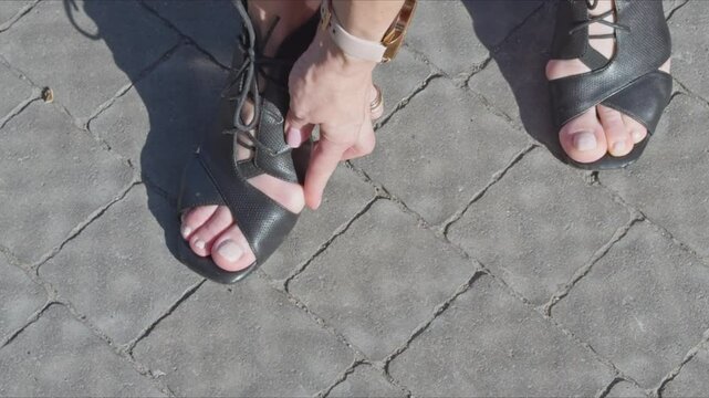Female feet with gout on big toe. woman experiences pain from wearing shoes.