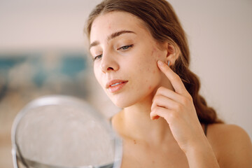 A young woman with problem skin is engaged in her skincare routine, gently touching her face while looking into a mirror in a well-lit, minimalist setting. Concept of acne therapy, scars, inflammation