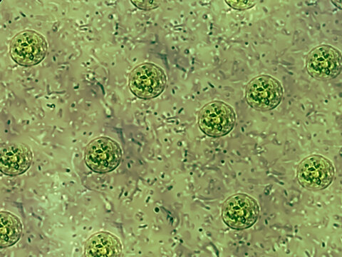 Microscopic view of stool sample showing Cyst of Entamoeba histolytica, Medical and health care concept