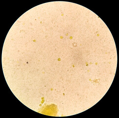 Microscopic view of stool sample showing Cyst of Entamoeba histolytica, Medical and health care...