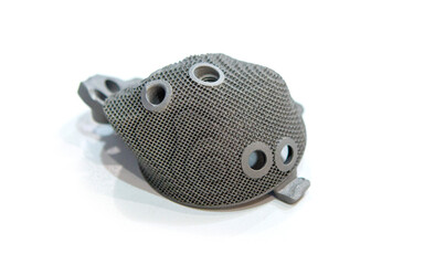 Implant of joint printed on a 3D printer from biocompatible titanium. Individual 3D-handled acetabular system. Endoprosthesis. Biointegrated patient-specific prosthesis. Medicine medical