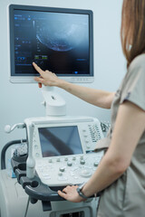 Ultrasound machine for body examination. Modern apparatus in the doctor's office.