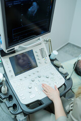 Ultrasound machine for body examination. Modern apparatus in the doctor's office.