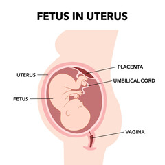 Fototapeta premium Fetus in Uterus During Pregnancy diagram infographic. Placental Location.