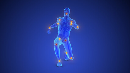 Chronic Pain in Multiple Body Joints
