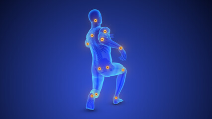 Chronic Pain in Multiple Body Joints