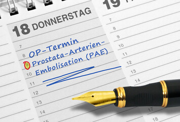 OP-Termin, neues Verfahren, Prostata-Arterien-Embolisation (PAE)
