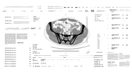MRI x ray CT Scan. Medical HUD monitoring. Futuristic Technological Interface. Sceleton, 3D Model.Healthcare.white