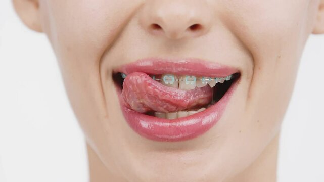 A close-up of a woman&rsquo;s teeth with full lips and braces. She runs her tongue over her teeth, showcasing her commitment to oral hygiene and confidence in her smile.