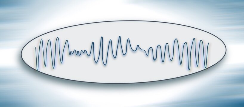 ECG image show torsades de pointes, illustration