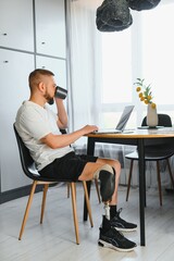 Man amputee with prosthetic leg disability on above knee transfemoral leg prosthesis artificial device using laptop at home. People with amputation disabilities everyday life