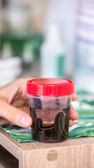 Close-up of doctors hand with leech in medical jar, selective focus. Hirudotherapy procedure. Hirudotherapy, Ethnoscience and Alternative medicine.  Bloodletting and rejuvenation treatment.