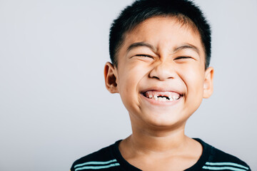 Smiling kid gap in upper teeth showing lost tooth. Child isolated portrait on white. Dental growth tooth fairy moment joyful development. Children show teeth new gap, dentist problems