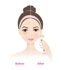 Before and after use jade roller massage tool on woman face vector illustration on white background. Reduce puffiness, wrinkles, dark circle under eyes, tighten pores size, improve elasticity of skin.