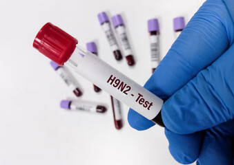 Blood Sample for Avian Influenza A (Subtype H9N2) test. H9N2 PCR test. Influenza virus. Rapid Influenza Antigen.