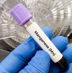 Blood sample for Manganese (Mn) test, to evaluate central nervous system, blood toxicity test....