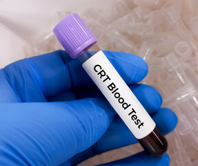 Blood sample for clot retraction test, to measures the time taken for a platelet plug to undergo...