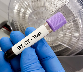 Blood test sample for BT, CT (bleeding time and clotting time) test.