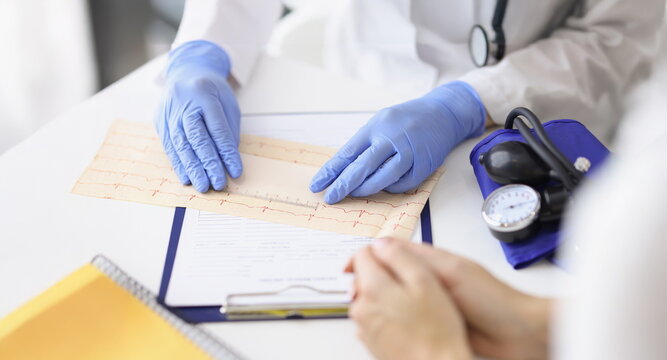 Close-up of professional cardiologist doctor examine electrogram scheme in clinic. Patient wait for result and prescription. Cardiology, checkup concept