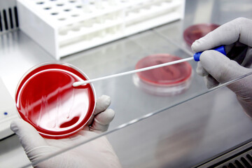 Scientist working in laboratory; technician hand streaking petri dish in the lab; Laboratory...