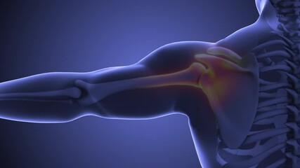 Animation depicting human shoulder discomfort