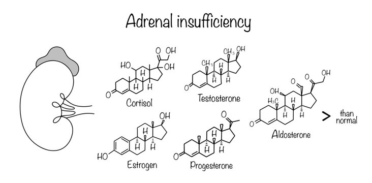 Adrenal insufficiency