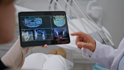 Dentist hands holding x-ray on tablet at consultation stomatology clinic closeup