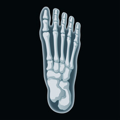 足のレントゲン画像