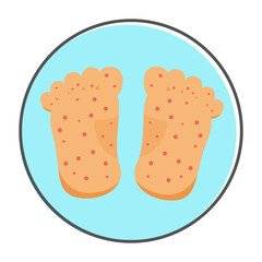 hand foot and mouth Disease symptoms. vector illustration
