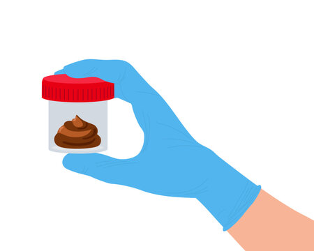 Medical sample in tube. Human hand wearing medical blue glove holding Jar for feces. Stool analysis. Laboratory container with excrement. Healthcare, medical diagnostic Flat Vector illustration.