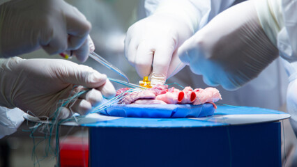 A team of surgeons are practicing artificial heart valve replacement surgery. Sutures are placed...