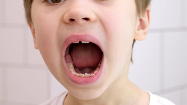 The child shows his tongue, teeth and tongue. Sessions with a speech therapist. Performing speech therapy exercises. Hygienic examination of the oral cavity. Milk and permanent teeth. Diastema. 4K
