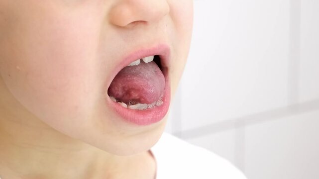Child shows his loose milk tooth presses and pushes it with his tongue. Open mouth close-up. Caucasian 6 year old kid in a white T-shirt on a bathroom background. lower incisor. Copy space. Body part