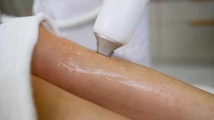 Beautician performing laser hair removal treatment on leg.