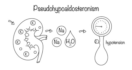 Pseudohypoaldosteronism