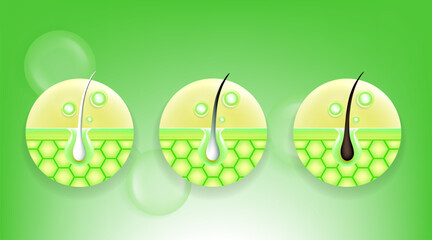 Hyaluronic acid and Niacinamide before and after gray hair and skin solutions ad, green collagen serum drops into skin cell with cosmetic advertising background ready to use, illustration vector.