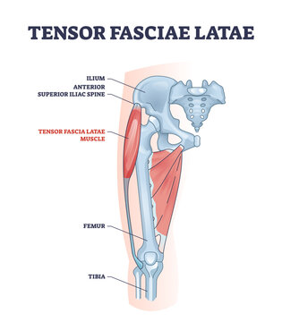 An anatomical diagram showing the Tensor Fasciae Latae muscle and its location on the hip and thigh, highlighting key skeletal structures, diagram, transparent background.