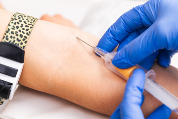 Nurse taking a blood sample from a patients arm