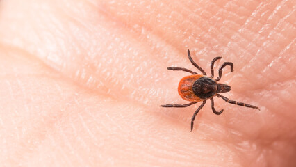 Top view of female castor bean tick on a human skin texture. Ixodes ricinus or scapularis. Closeup of parasitic insect mite, carrier of encephalitis infection. Tick-borne diseases transmission danger.