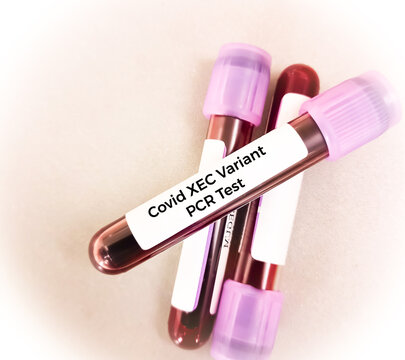 Blood sample for Omicron Sub-variant KS.1.1 and KP.3.3 test, Covid XEC Variant